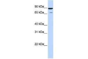 WB Suggested Anti-HIPK4 Antibody Titration: 0. (HIPK4 anticorps  (Middle Region))