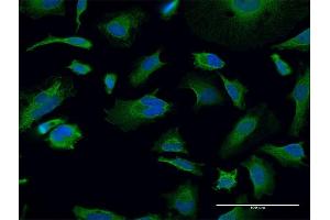 Immunofluorescence of monoclonal antibody to TGM2 on HeLa cell.