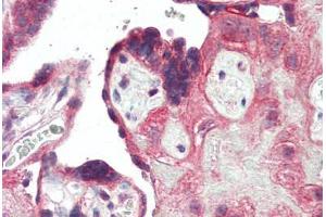 Human Placenta (formalin-fixed, paraffin-embedded) stained with TLR3 antibody ABIN461896 at 5 ug/ml followed by biotinylated goat anti-rabbit IgG secondary antibody ABIN481713, alkaline phosphatase-streptavidin and chromogen.