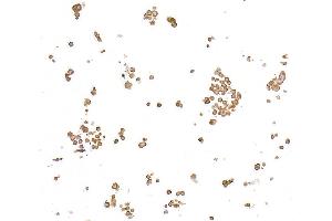 Immunocytochemistry (ICC) image for anti-Nuclear Factor of kappa Light Polypeptide Gene Enhancer in B-Cells 1 (NFKB1) (C-Term) antibody (ABIN7795778)