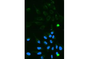 Immunofluorescence analysis of MCF7 cell using UGT1A9 antibody. (UGT1A9 anticorps  (AA 26-250))