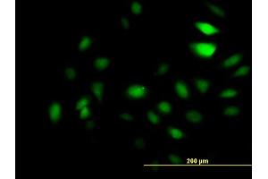 Immunofluorescence of monoclonal antibody to GCN5L2 on HeLa cell.