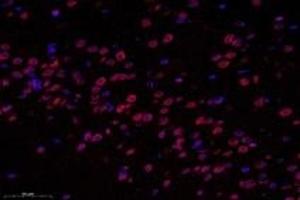 Immunofluorescent analysis of paraformaldehyde-fixed rat hippocampus using SUN2 (ABIN7075502) at dilution of 1: 1000 (SUN2 anticorps)