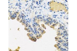 Immunohistochemistry of paraffin-embedded Mouse lung using ANGPT1 Polyclonal Antibody at dilution of 1:100 (40x lens).