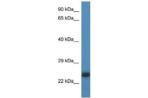 WB Suggested Anti-LOC100359980 Antibody Titration: 1. (LOC100359980 anticorps  (N-Term))