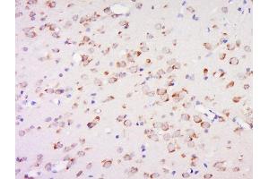 Paraformaldehyde-fixed, paraffin embedded (Species/Tissue), Antigen retrieval by boiling in sodium citrate buffer (pH6) for 15min, Block endogenous peroxidase by 3% hydrogen peroxide for 30 minutes, Blocking buffer (normal goat serum) at 37°C for 20min, Antibody incubation with Rabbit Anti-5 MethylCytosine Polyclonal Antibody, Unconjugated  at 1:500 overnight at 4°C, followed by a conjugated secondary for 90 minutes and DAB staining.
