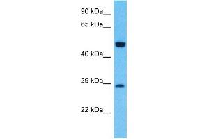 Host:  Rabbit  Target Name:  GLRB  Sample Type:  Fetal Lung lysates  Antibody Dilution:  1. (GLRB anticorps  (N-Term))
