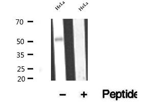 Western blot analysis of extracts of HeLa cells, using BBS4 antibody. (BBS4 anticorps  (Internal Region))