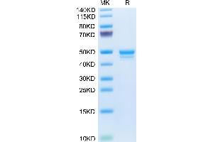 Mouse MCEMP1 on Tris-Bis PAGE under reduced condition. (MCEMP1 Protein (AA 92-183) (Fc Tag))