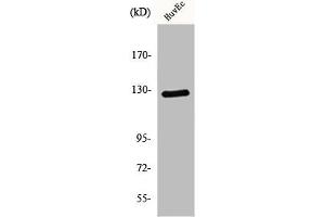Western Blot analysis of HuvEc cells using MSH3 Polyclonal Antibody (MSH3 anticorps  (N-Term))
