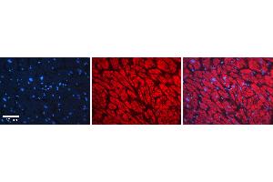 Rabbit Anti-NFKBIA Antibody   Formalin Fixed Paraffin Embedded Tissue: Human heart Tissue Observed Staining: Cytoplasmic Primary Antibody Concentration: N/A Other Working Concentrations: 1:600 Secondary Antibody: Donkey anti-Rabbit-Cy3 Secondary Antibody Concentration: 1:200 Magnification: 20X Exposure Time: 0.