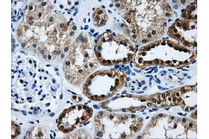 Immunohistochemical staining of paraffin-embedded Kidney tissue using anti-GBE1 mouse monoclonal antibody. (GBE1 anticorps)