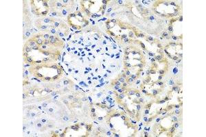 Immunohistochemistry of paraffin-embedded Rat kidney using SCG3 Polyclonal Antibody at dilution of 1:100 (40x lens). (SCG3 anticorps)