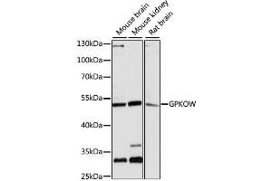 Western blot analysis of extracts of various cell lines, using GPKOW antibody (ABIN6293325) at 1:3000 dilution. (GPKOW anticorps)