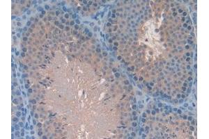 Detection of MAPK7 in Mouse Testis Tissue using Polyclonal Antibody to Mitogen Activated Protein Kinase 7 (MAPK7)