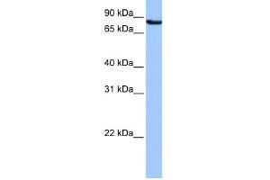WB Suggested Anti-UBQLN3 Antibody Titration: 0. (Ubiquilin 3 anticorps  (N-Term))