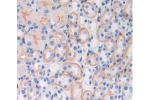 Used in DAB staining on fromalin fixed paraffin- embedded kidney tissue (Abcd2 anticorps  (AA 501-695))