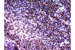 Formalin-fixed, paraffin-embedded human tonsil stained with NuMA antibody (A73-B/D12) (NUMA1 anticorps)