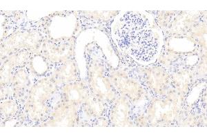 Detection of GSTA4 in Human Kidney Tissue using Polyclonal Antibody to Glutathione S Transferase A4 (GSTA4)