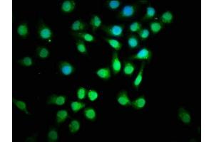 Immunofluorescence staining of A549 cells with ABIN7160232 at 1:129, counter-stained with DAPI.