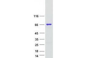 Validation with Western Blot
