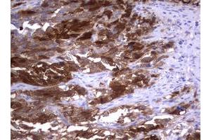 Image no. 4 for anti-Thymidylate Synthetase (TYMS) antibody (ABIN1501589)