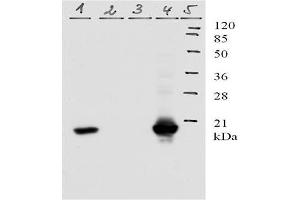 Picture: Western-Blot analysis of HPV-11 E7 protein. (Human Papilloma Virus 11 E7 (HPV-11 E7) (AA 1-35) anticorps)