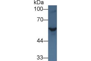 Western blot analysis of Rat Serum, using Rat SHH Antibody (1 µg/ml) and HRP-conjugated Goat Anti-Rabbit antibody ( (Sonic Hedgehog anticorps  (AA 237-399))