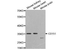 Western blot analysis of extracts of various cell lines, using CD151 antibody. (CD151 anticorps  (AA 113-221))