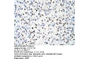 Rabbit Anti-MSI2 Antibody  Paraffin Embedded Tissue: Human Heart Cellular Data: Myocardial cells Antibody Concentration: 4.