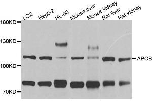 Western blot analysis of extracts of various cell lines, using APOB antibody. (APOB anticorps)
