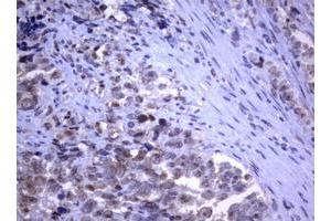 Image no. 4 for anti-RAS Guanyl Releasing Protein 3 (Calcium and DAG-Regulated) (RASGRP3) (AA 380-690) antibody (ABIN1491477)