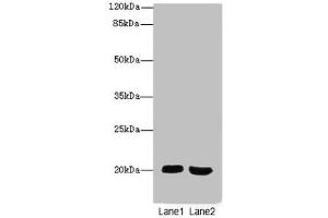 Western blot All lanes: MSRB2antibody at 2. (MSRB2 anticorps  (AA 10-182))