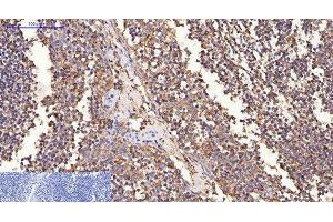 Immunohistochemistry of paraffin-embedded Human tonsil tissue using ERBB2 Monoclonal Antibody at dilution of 1:200. (ErbB2/Her2 anticorps)