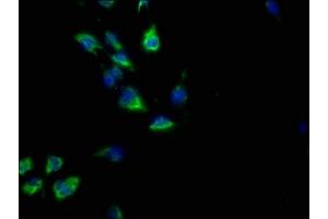 Immunofluorescence staining of U251 cells with ABIN7139867 at 1:50, counter-stained with DAPI. (GNG2 anticorps  (AA 44-62))