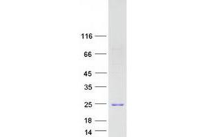Validation with Western Blot