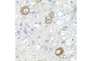 Immunohistochemistry of paraffin-embedded rat brain using NRG4 antibody (ABIN1873958) at dilution of 1:100 (40x lens). (Neuregulin 4 anticorps)