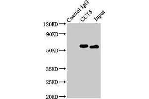 Immunoprecipitating CCT5 in Hela whole cell lysate Lane 1: Rabbit control IgG (1 μg) instead of ABIN7171417 in Hela whole cell lysate. (CCT5 anticorps  (AA 1-270))