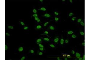 Image no. 6 for anti-Cytidine Monophosphate N-Acetylneuraminic Acid Synthetase (CMAS) (AA 164-264) antibody (ABIN466224) (CMAS anticorps  (AA 164-264))