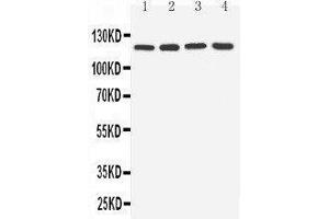 Anti-TLR7 antibody, Western blotting Lane 1: Rat Spleen Tissue Lysate Lane 2: Rat Liver Tissue Lysate Lane 3: U87 Cell Lysate Lane 4: A549 Cell Lysate