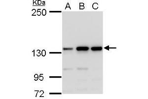 WB Image MSH3 antibody detects MSH3 protein by western blot analysis. (MSH3 anticorps  (N-Term))