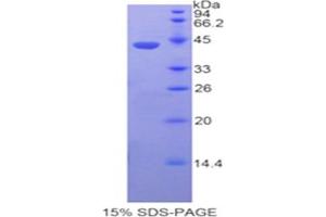 SDS-PAGE analysis of Human Fibulin 4 Protein.
