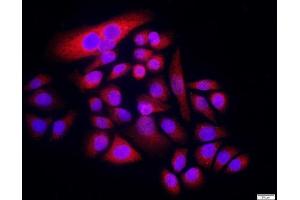 MCF-7 cells were stained with ENT2 Polyclonal Antibody, Unconjugated at 1:500 in PBS and incubated for two hours at 37°C followed by Goat Anti-Rabbit IgG (H+L) Cy3 conjugated secondary antibody.