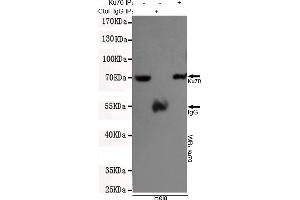 Immunoprecipitation analysis of Hela cell lysates using Ku70 mouse mAb. (XRCC6 anticorps)