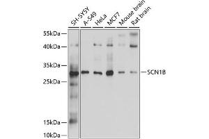 Western blot analysis of extracts of various cell lines, using SCN1B antibody (ABIN6132634, ABIN6147433, ABIN6147434 and ABIN6214194) at 1:1000 dilution. (SCN1B anticorps  (AA 19-160))