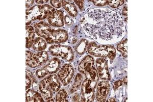 Immunohistochemical staining of human kidney with CMC1 polyclonal antibody  shows strong cytoplasmic positivity in cells in tubules. (CMC1 anticorps)