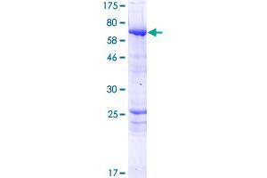 Image no. 1 for Protein Phosphatase 2, Regulatory Subunit B'', gamma (PPP2R3C) (AA 1-453) protein (GST tag) (ABIN1316040)