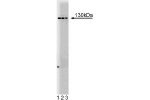 Western blot analysis of M-Cadherin on mouse neonate lysate. (CDH15 anticorps  (AA 253-366))
