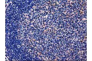 Image no. 6 for anti-UDP-Galactose-4-Epimerase (GALE) antibody (ABIN1498366) (GALE anticorps)