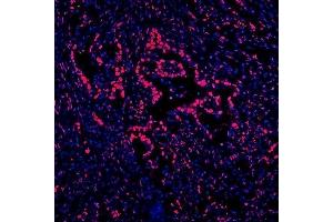 IF analysis of DDX5 using anti-DDX5 antibody (ABIN7602561). (DDX5 anticorps  (AA 85-328))